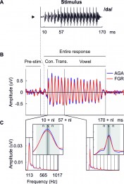 The FFR in neonates with fetal growth restriction (red) and their peers born with weight adequate for gestational age (blue). Statistical differences were found for the signal to noise ratio, as retrieved from the quotient between the signal (amplitude at the F0 peak; s) and the average of the amplitude at its flanks (n).