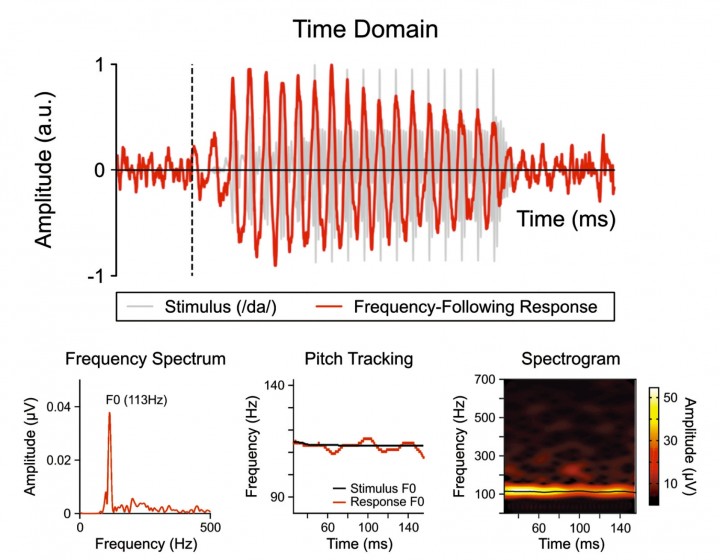The neonatal FFR and the different analytical approaches to quantify the neural response.