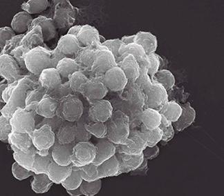 La regulación del ciclo vital de una ameba podría ser la clave del origen de la multicelularidad de 