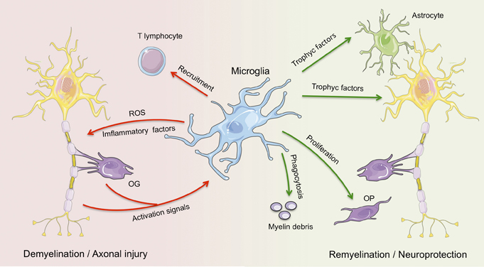 Role of mcroglia in multiple sclerosis pathophysiology