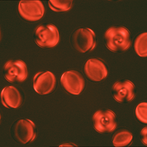 Lyotropic Chromonic Liquid Crystals Lyotropic Chromonic Liquid Crystals