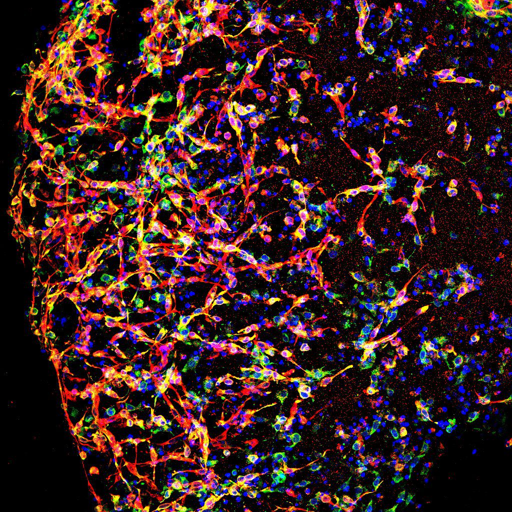 Fotografia per acompanyar la notícia de l'article de la Inés amb col·laboració amb la Clelia. Cèl·lules encapsulades a l'hidrogel desenvolupat per bioimpressió 3D. La foto mostra que la biotinta permet la diferenciació de cèl·lules progenitores neuronals i la formació de la xarxa neural.