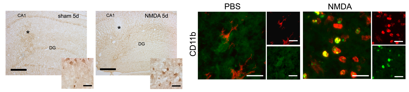 Marcaje de las células microgliales formadas de nuevo tras una lesión hipocampal