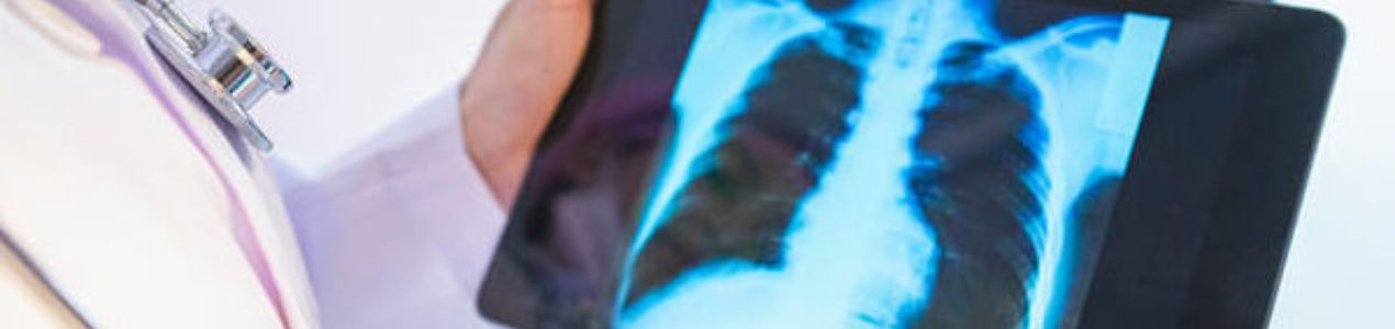 Metge amb una radiografia de pulmó