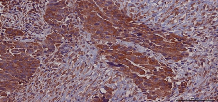 Senyalització molecular