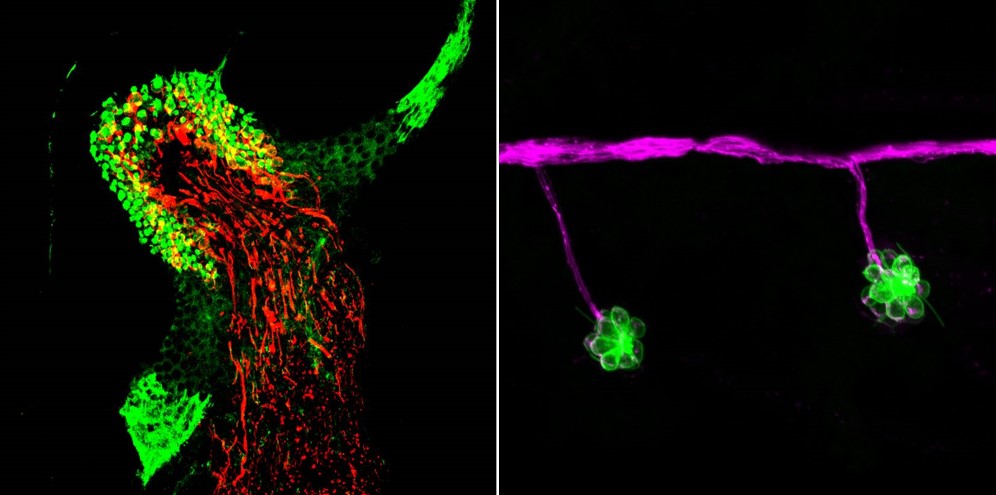 Fisiopatologia de sistemes mecanoreceptors